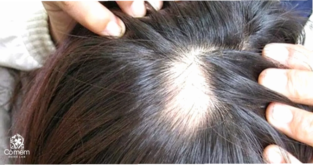 Kiên trì phục hồi tóc duỗi bị gãy