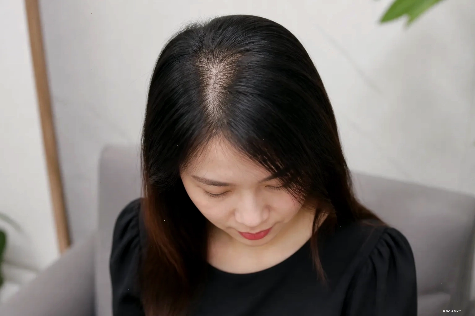 Nối tóc lấp thưa, hói đỉnh đầu bằng topper hoặc nối viền