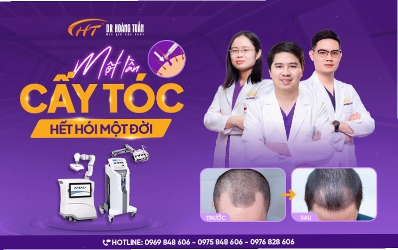 Quy trình cấy tóc tự thân FUE tại Dr Hoàng Tuấn